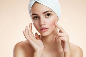 Acne Skin Care
